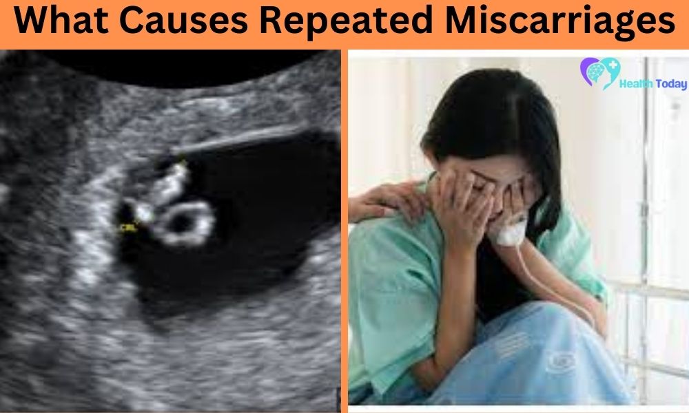 What Causes Repeated Miscarriages